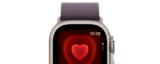 Apple defeats AliveCor bid to dam U.S. Apple Watch imports