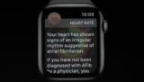 Apple wins patent battle in opposition to AliveCor