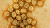 New COVID variant swiftly positive aspects floor in US; concern looms for summer time wave