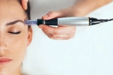 Microneedling: Advantages, at-home dangers, outcomes and restoration
